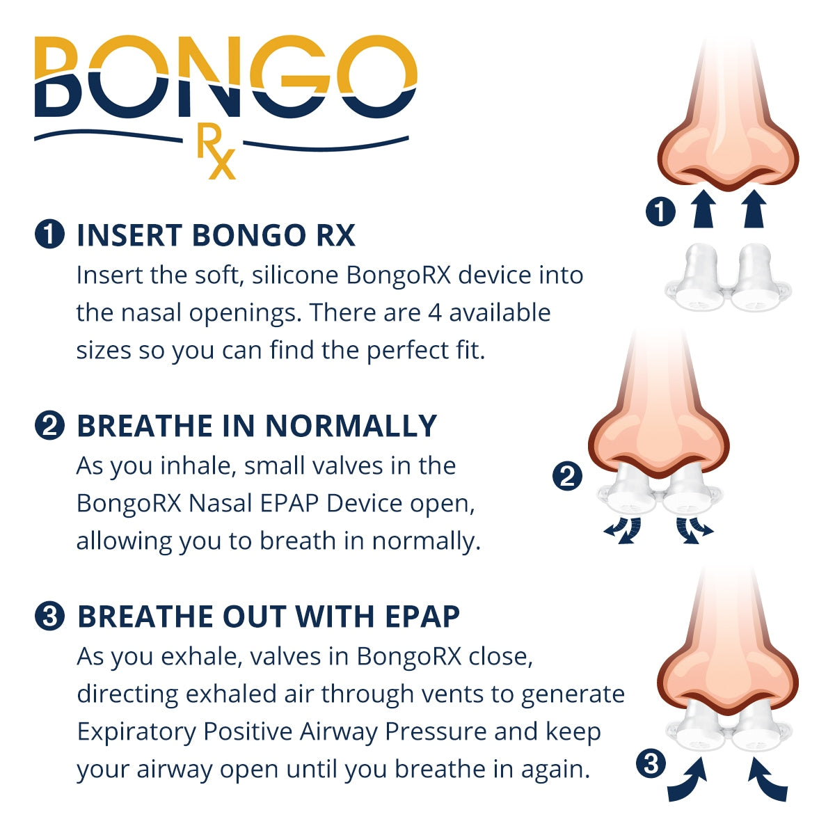 Bongo RX EPAP Device Starter Kit